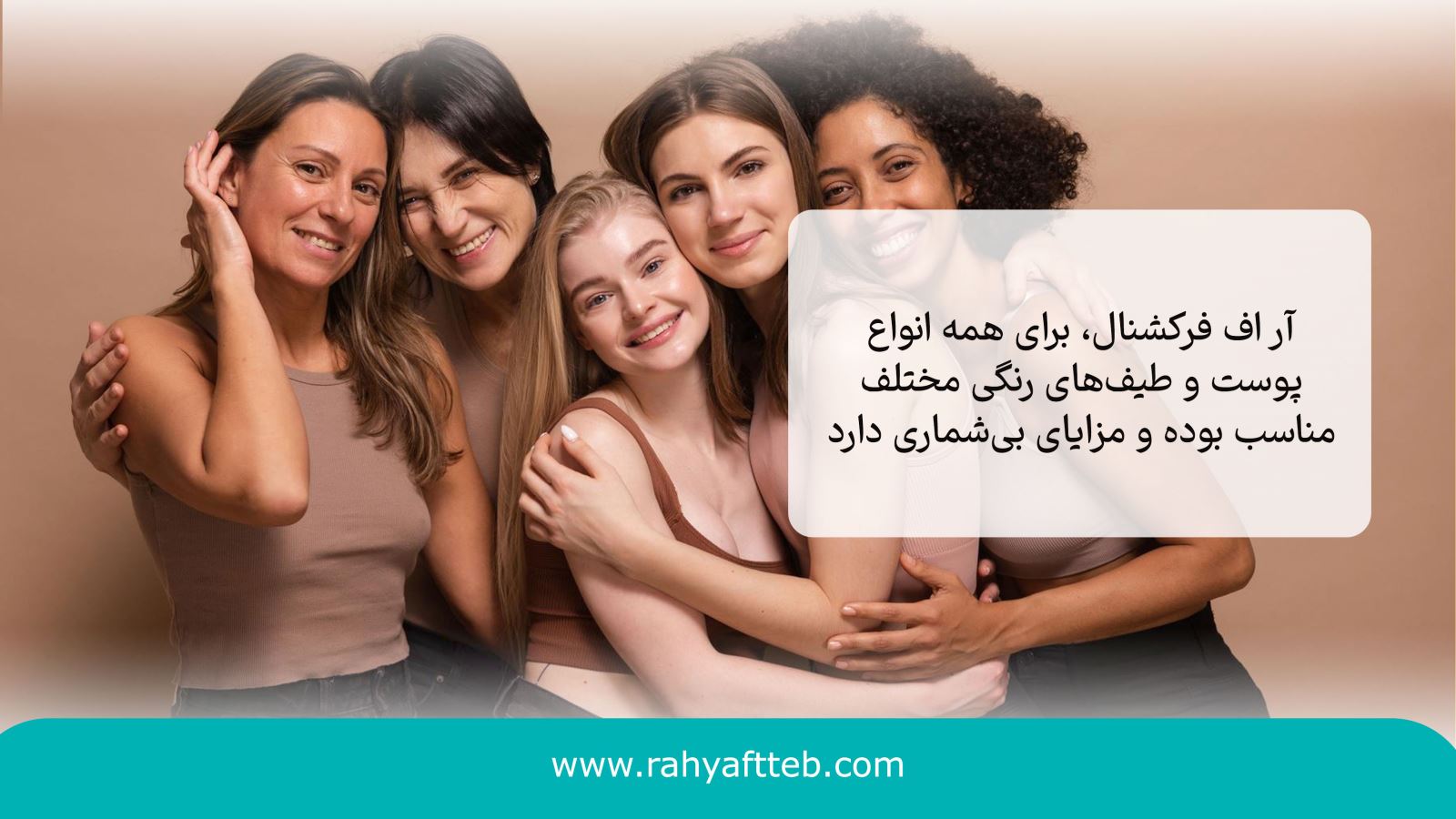 مزایای روش آر اف فرکشنال