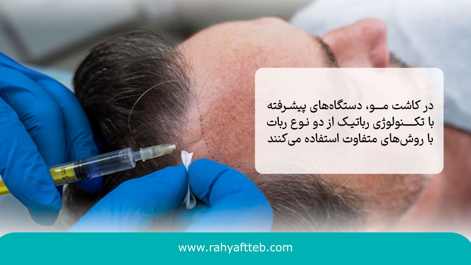 مراقبتهای بعد از هایفوتراپی