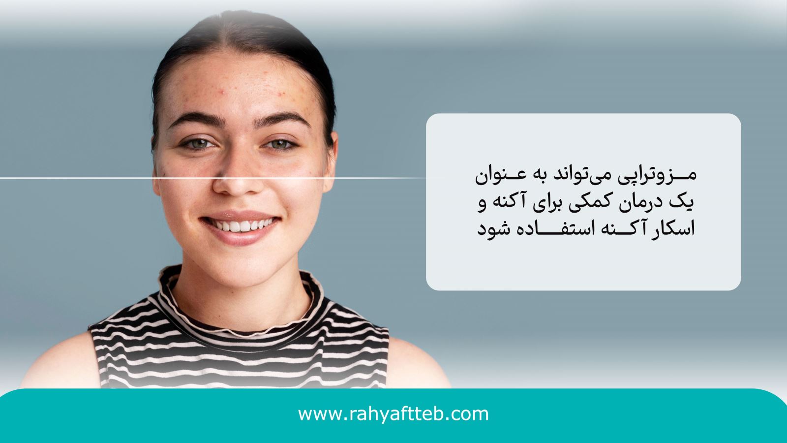 مزایای مزوتراپی